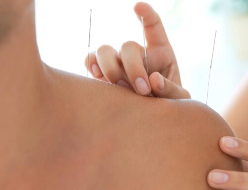 La Office of Workers’ Compensation Supports Acupuncture Therapy