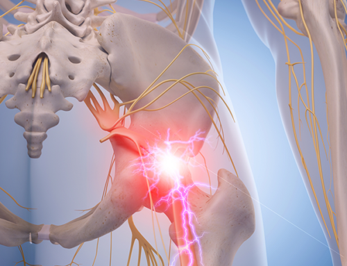 Did you know sciatic pain can be remedied naturally?